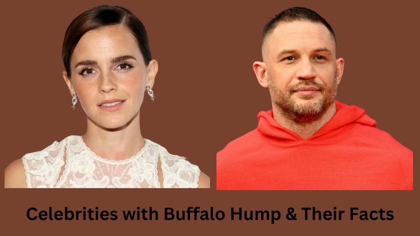 Celebrities with Buffalo Hump & Their Facts